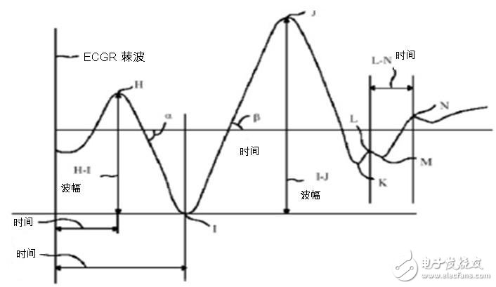 圖二：心臟沖擊掃描圖波形。