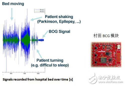 村田智能BCG方案，打造主動(dòng)健康監(jiān)測
