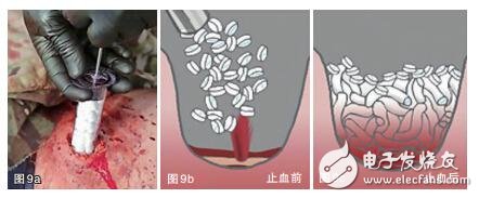 【盤點(diǎn)】2015十大醫(yī)療黑科技