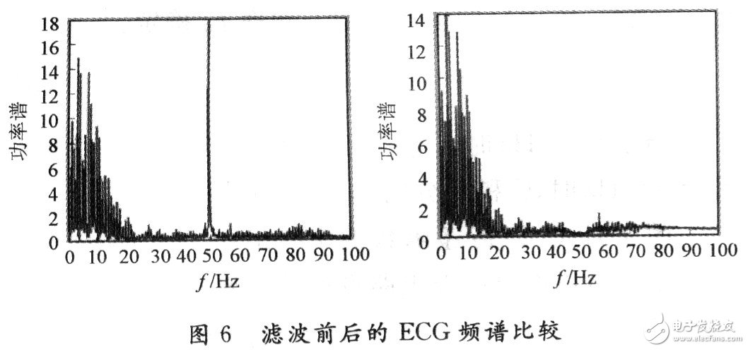  低噪聲便攜式的心電監(jiān)測儀設計和實現(xiàn)