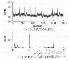 心電信號(hào)檢測中濾除肌電干擾的方法解析